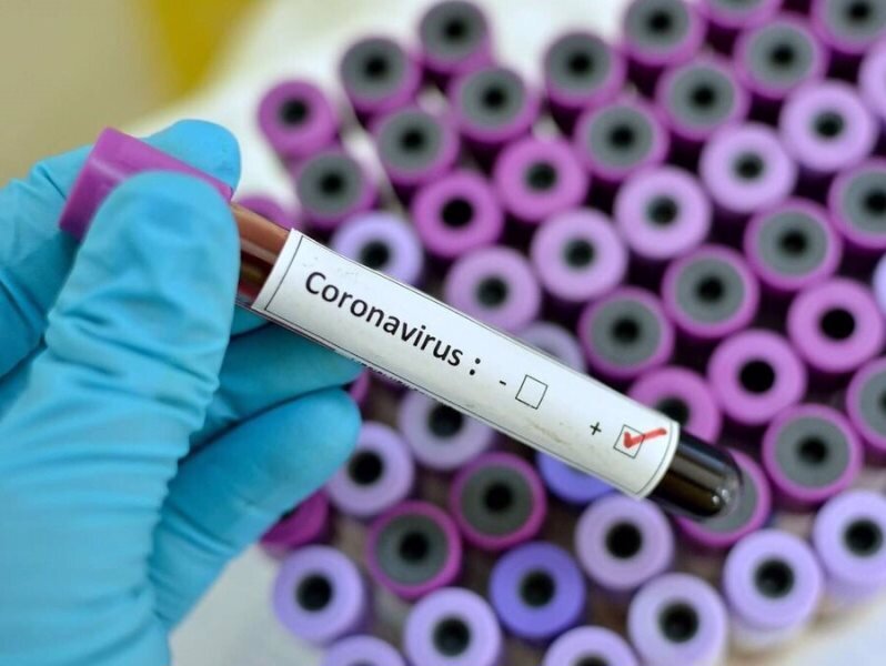 ویروس کرونا (CORONA VIRUS)